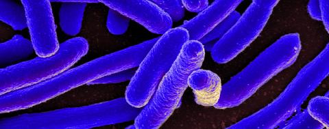 Scanning electron micrograph of Escherichia coli