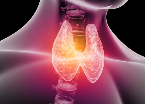 Thyroid cancer