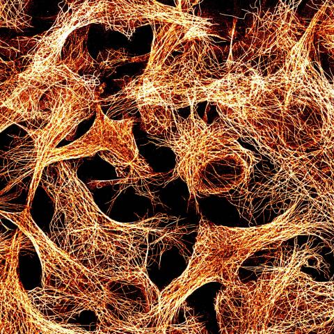 Tubulin in COS7 cells seen by Abbelight's SAFe180/Large FOV system